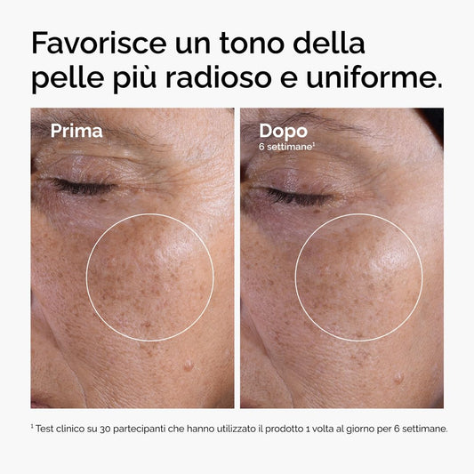 The Ordinary Glycolic Acid 7% Exfoliating Toner, Esfoliante Acido Glicolico, Tonico quotidiano illuminante e levigante per un tono della pelle più uniforme, 240ml