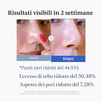 medicube Zero Pore Pads 2.0 Tamponi Tonici Per Il Viso A Doppia Texture Per L'Esfoliazione E La Cura Dei Pori Con Acido Lattico Al 4,5% E Acido Salicilico Bha Allo 0,45%, (70 Unità)